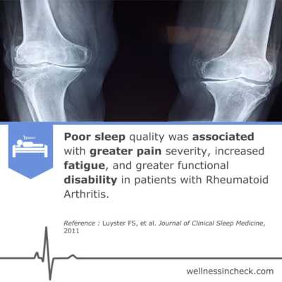 Rheumatoid Arthritis Sleep Deprivation