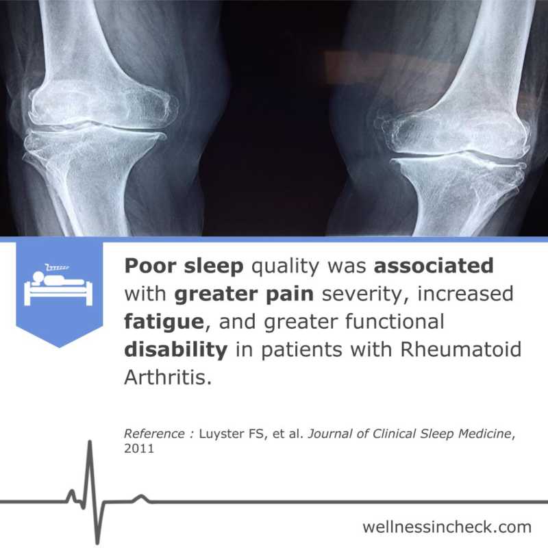 Rheumatoid Arthritis Sleep Deprivation